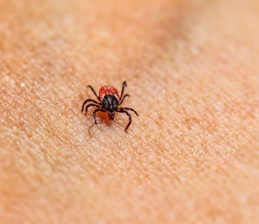 How to Prevent Parasites Without Harsh Chemicals