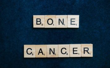 How to Keep Your Puppys Bones and Joints Healthy