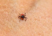 Best Ways to Prevent Parasites in Puppies